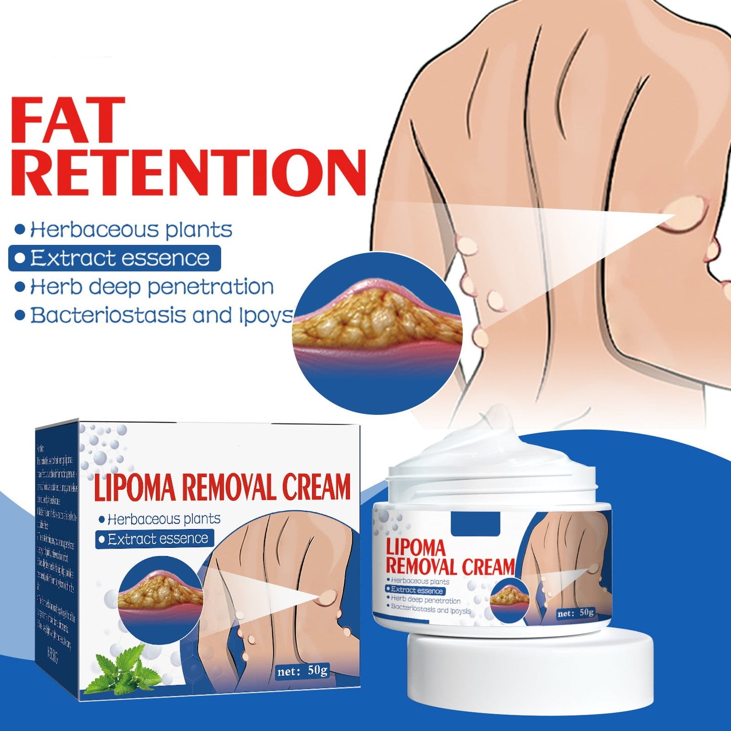 Lipoma Removal Cream