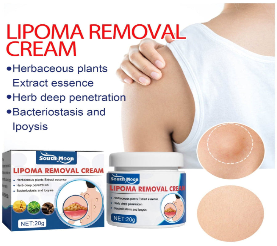 Lipoma Removal Cream