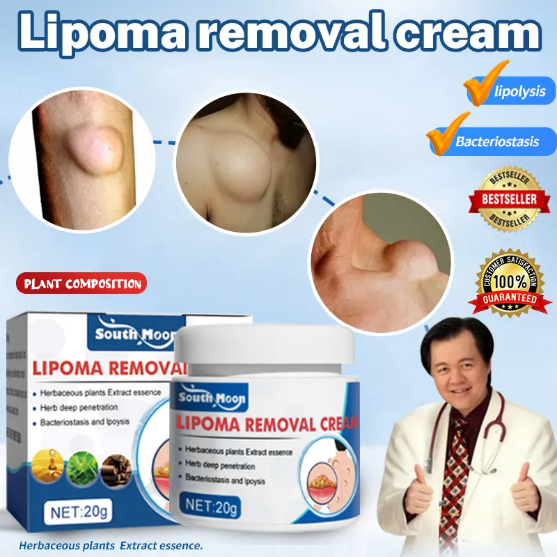 Lipoma Removal Cream
